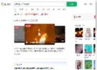 火把节跳火堆二级烧伤_360搜索