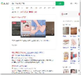 被蚊子咬后发热关节痛_360搜索